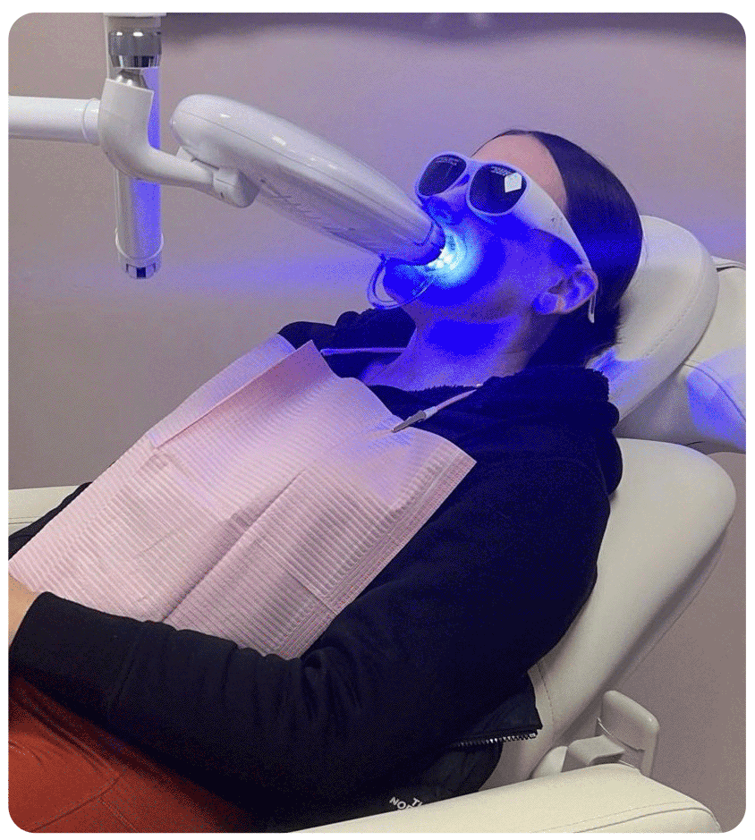 woman during the process of teeth whitening