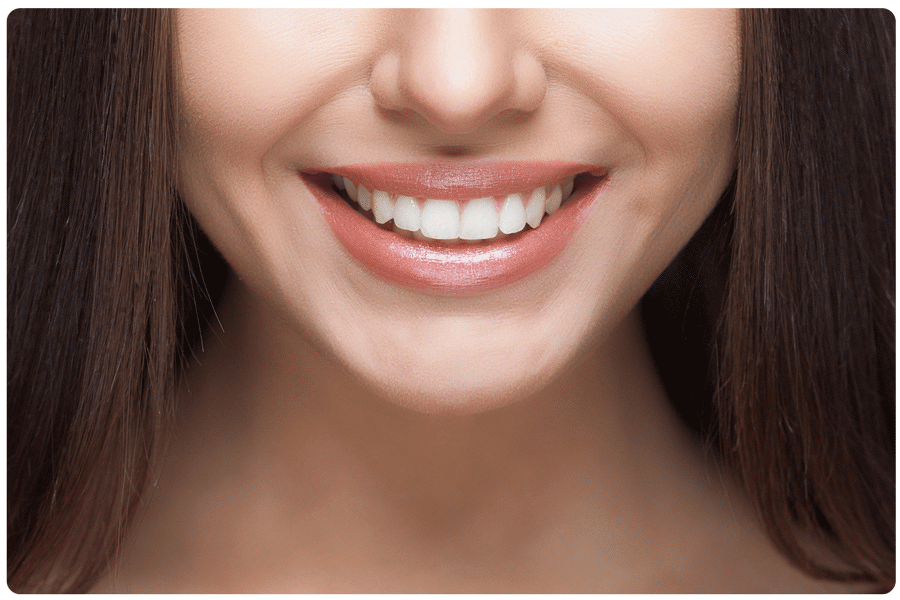 close up of woman's smile after teeth whitening