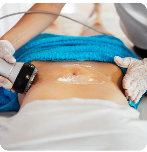 Cryolipolysis machine is being used on a stomache