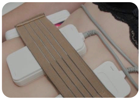 closeup of lipo pads strapped to woman's midsection